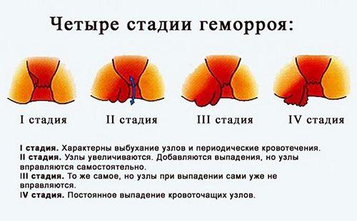 Четири етапа във фигурата.