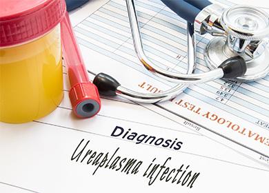 ureaplasmosis نقش